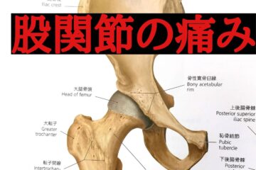 股関節の痛み